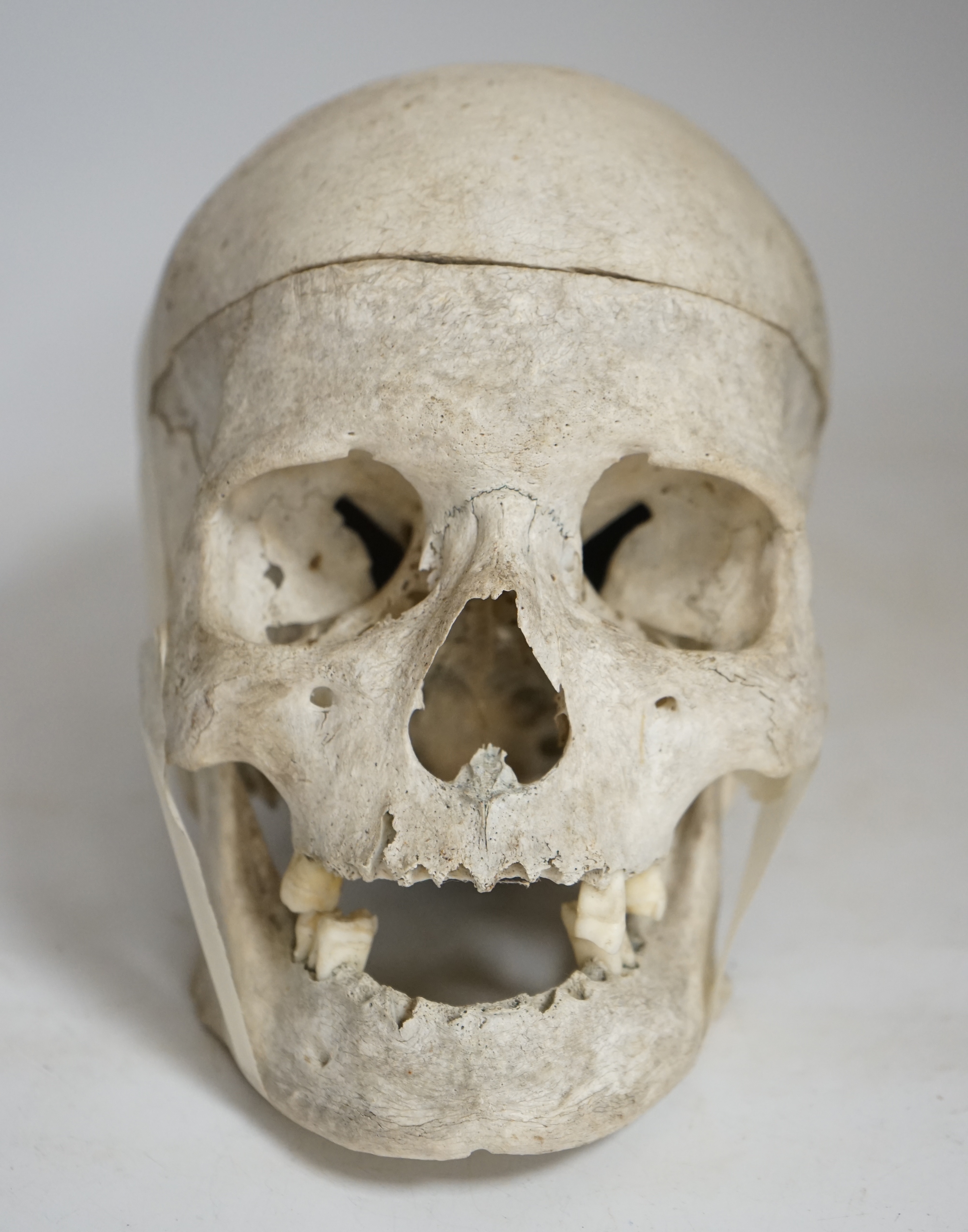 Human Anatomy - An Antique anatomical human skull, with lower jaw